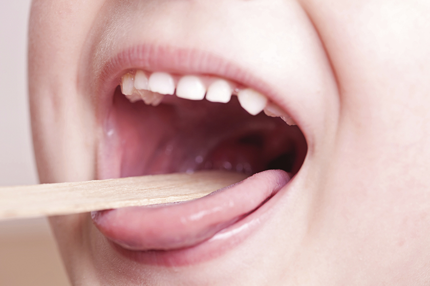 strep throat in children