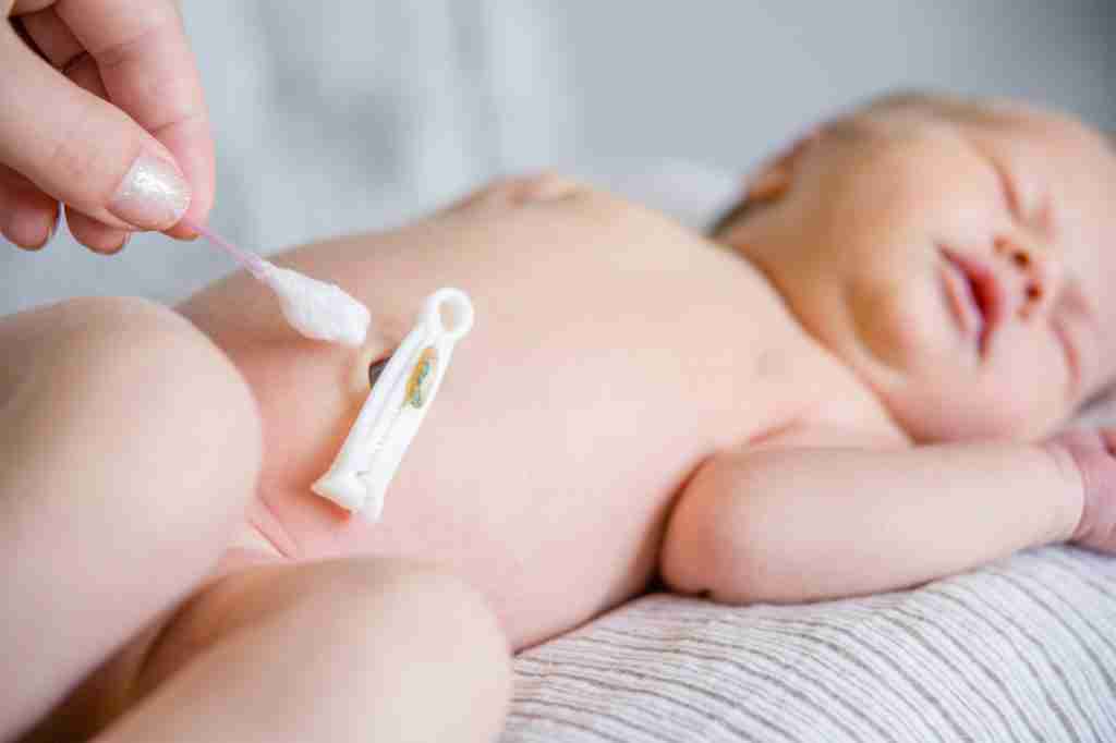 what to do about umbilical cord after birth