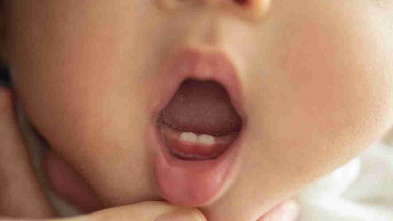 teething age in children